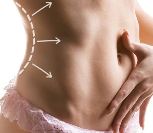 Liposuzione Roma Liposuzione Roma