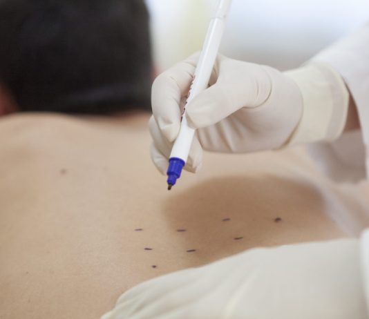 Iniezioni di Ozono Roma Iniezioni di Ozono Roma